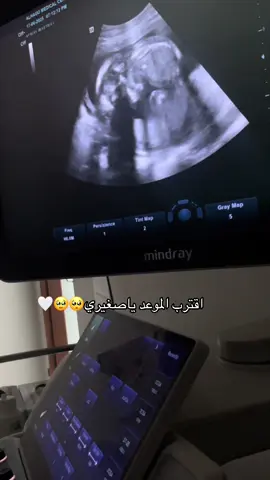 اللهم بلغني شوفة جنيني وهو بكامل صحته وعافيته🤍#بيبي #حوامل #حوامل_الشهر_التاسع #حمل #اكسبلور 