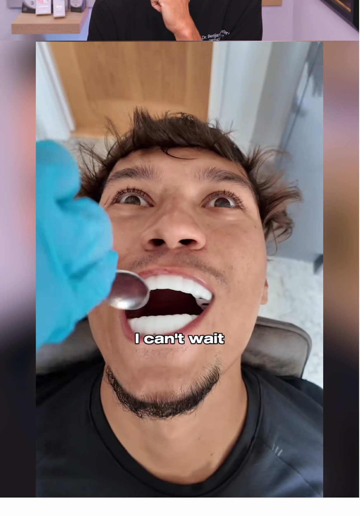 When That One Person Gets VENEERS! 😁🦷 #teeth #braces #veneers 