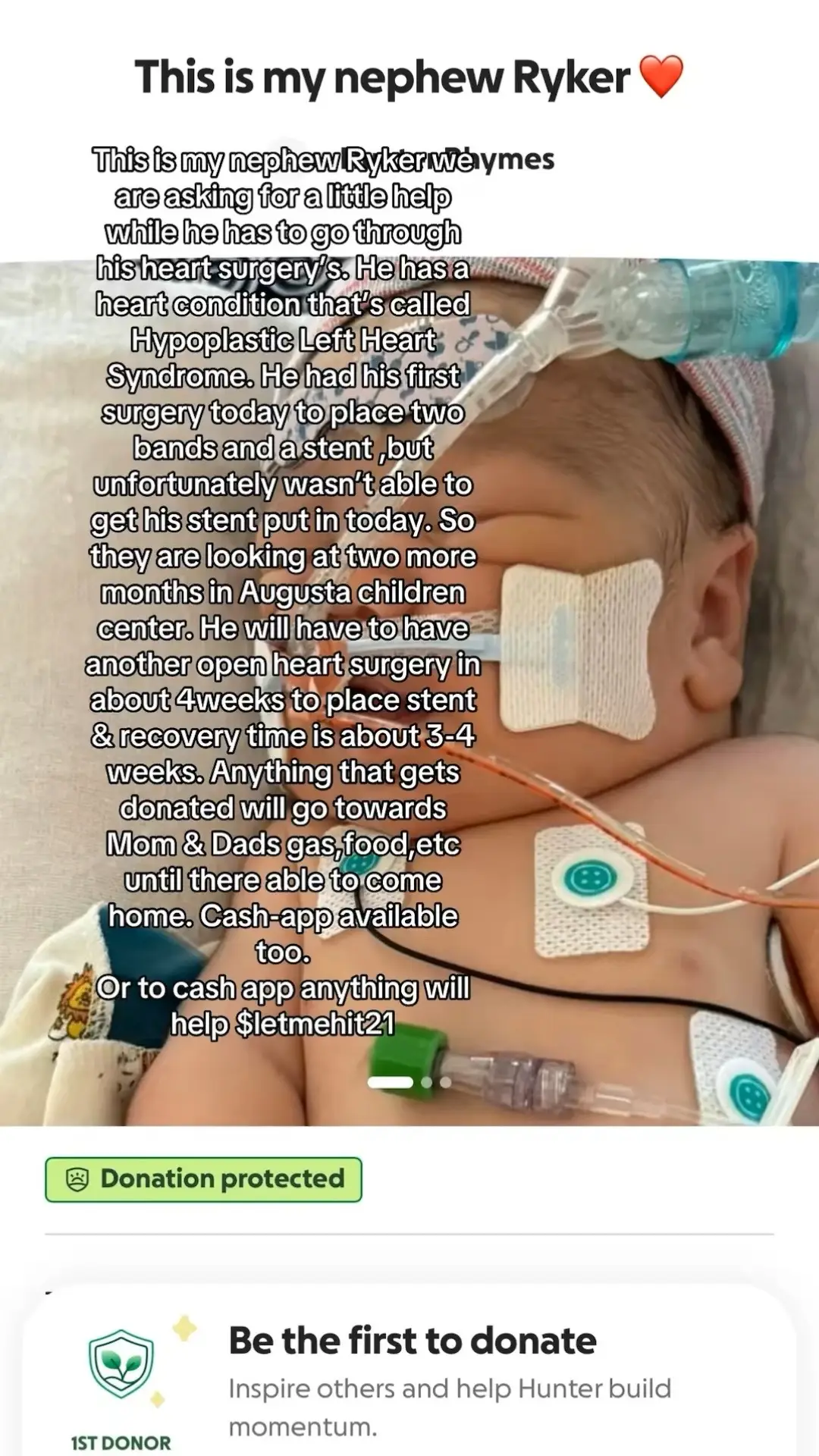 Anything you send well be given to my brothers family #fyp #babynephewloading #heartsurgery 