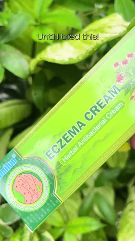 This eczema cream is just for eczema only!🍃💚