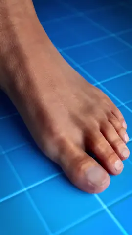 Bones 🦴 surgery #healthyrecipes #healttips #fyp #foruyou #viral_video 