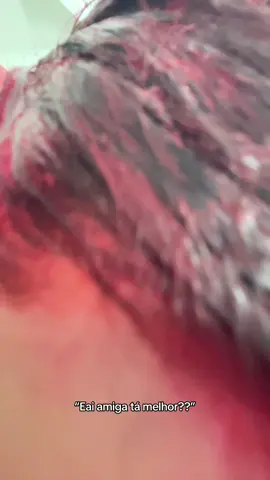 Pós trauma #cabelo 