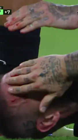 🚨 ¡Sergio Ramos está sangrando del rostro por un patadón de Anthony Lozano! 😱🤕