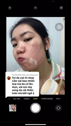 Trả lời @Chees.eiu Từ ngày xài kem này da hết sạch mụn trắng lên từng ngày, DA ĐẸP là AUTO xênh gái #tiktok #demejine #trắngda #hetmun 