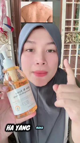 Yang mana kulit sensitit , ad mslh gatal2 , jerawat dkt badan blh try tau body wash dari quaxery ni tauuu 🥰bau wangiiii 🥰🔥#quarxery#bodywash 