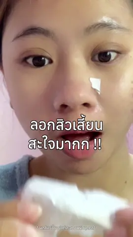 สะใจมากที่สุด ! #NakizThailand #Nakiz  #LivelyButt  