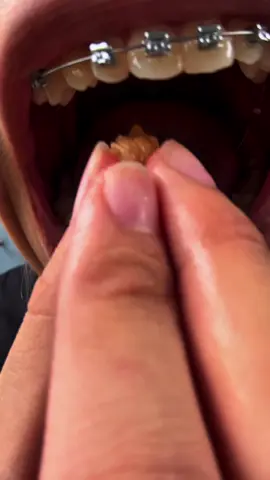 Truyền thuyết hũ chanh muối