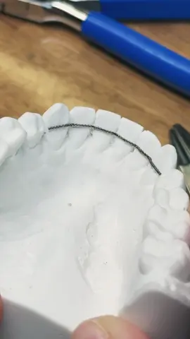 Retainer Making one takes precision, patience, and a lot of wire bending. Of course, there are other ways to make retainers, like digital methods. Lately, I’ve even seen retainers made from PEEK. Have you tried it yet? What’s your experience? #dentallab #dentaltech #retainer #afterbraces 