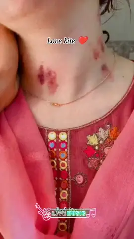LoVe Bite.....💋 #romance #cupcut #bollywood #fyppppppppppppppppppppppp #foryoupage 