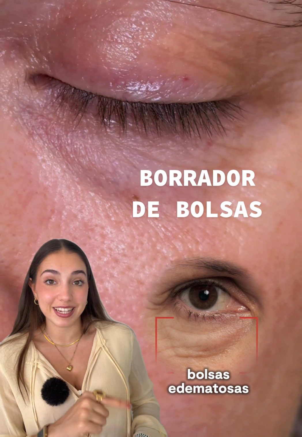 Publi. Para disimular tus bolsas de líquido cada mañana la mejor solución es el nuevo borrador de bolsas instantáneo de @L’Oréal Paris ✨ Solo 15 minutos y una pequeña cantidad harán magia 🙂‍↔️ Pruébalo y me cuentas! #lorealparisskincare #borradordebolsas #bolsas #contornodeojos #skincare 
