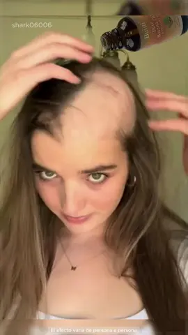 'El champu que me recomendó mi amigo doctor es realmente bueno. Si sufres de una fuerte caída del cabello,¡tienes que probarlo!