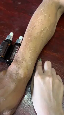 Jgn lupa eksfoliasi ya, biar ga kusam kulitnya 😍 #peelingserum #serumviral #laushine #fyp #foryoupage 