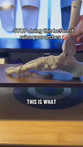 Heel pain? Plantar fasciitis? 👣 These slides are the #1 fix—designed by PTs for real arch support. Your feet will thank you. #archsupport #painrelief #FlatFeet #footpain @Archies Footwear 