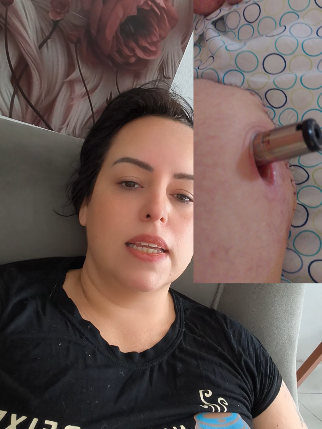 Respondendo a @jessistyle7871  pq tô amarando o coto. preparando para osseointegração  #osseointegration #gratidao #pcd 