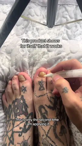 It’s gross but it works really well, I also don’t know how to advertise this but I’ll keep using it to show you 😂 #ad #antifungal #tiktokmademebuyit #hygiene 