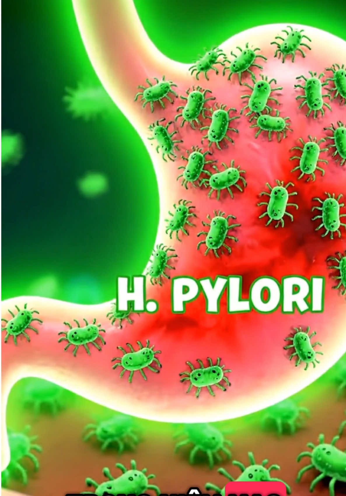 Đau bụng, ợ chua, mất ngủ… coi chừng là Mr.Axit ghé thăm đó nha 🤯 #canhatcuoito #suckhoe #healthy #hatdinhduong #daudaday 