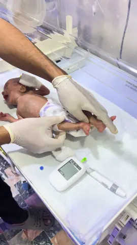 Cheak RBS level in neonatal normal RBS level in neonat ?#pleasetiktokteam#30milionvewes#virolbabyjourney#foryoupage