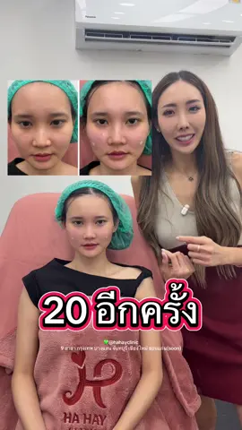 ขมับ ยกหน้าแก้ม แก้มตอบ ปาก คาง #หมอป๊อปยกหน้า #แก๊งฮาเฮ #ไหมน้ำหมอป๊อป #ร้อยไหมหมอป๊อป 