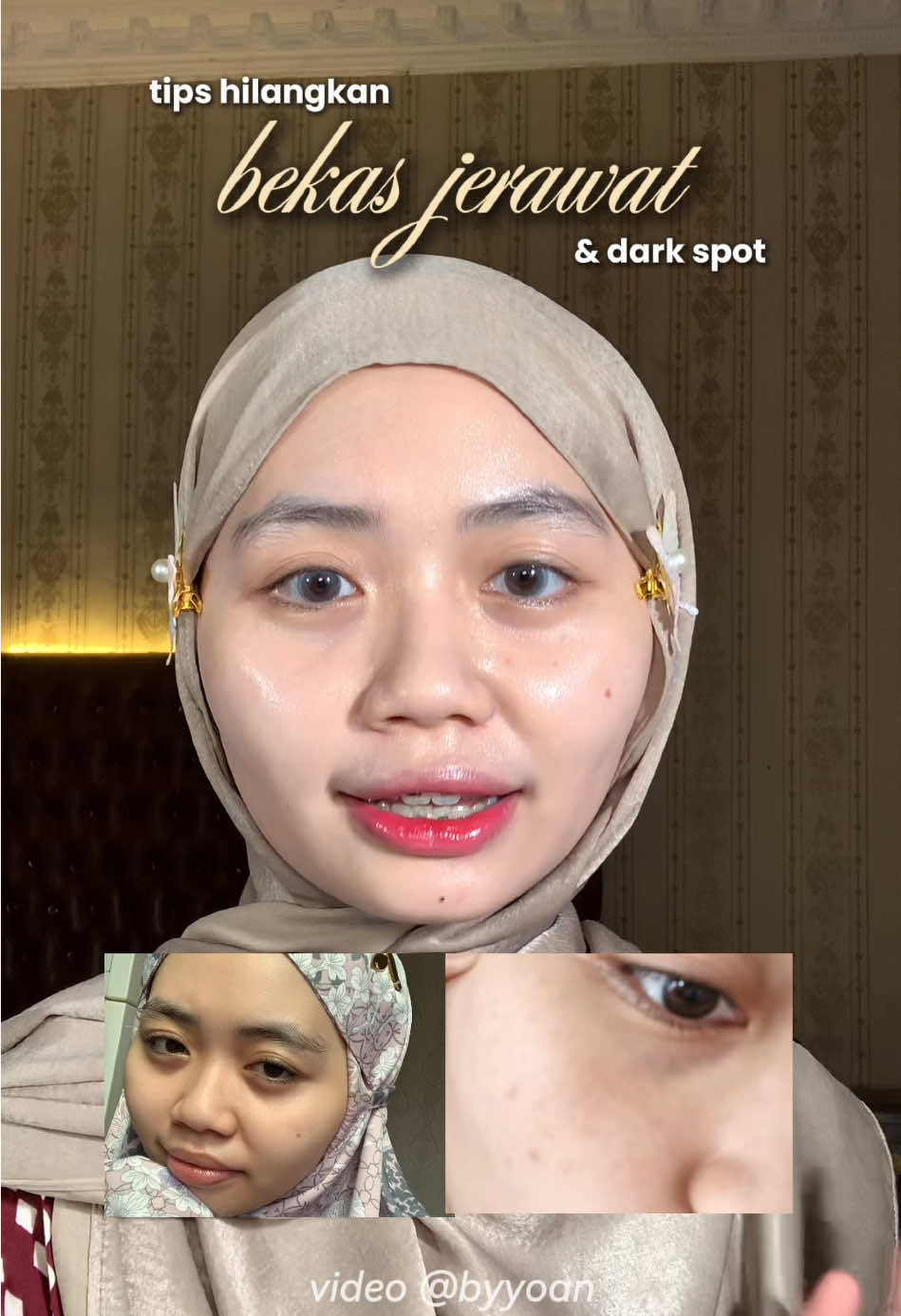 Membalas @daisiescutie_ ada yang punya masalah sama kulit kusam? dark spot? cobain set brightening dari fav beauty ini deh✨ #skincareroutine #brighteningseries #viral #ReviewSkincare #favbeauty 