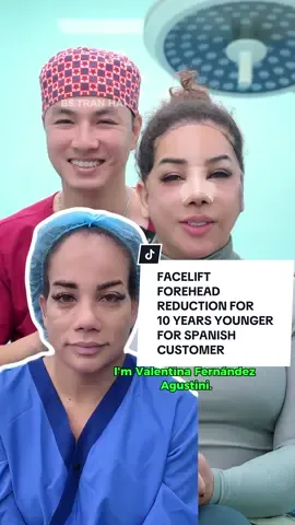 FACELIFT - FOREHEAD REDUCTION FOR 10 YEARS YOUNGER FOR SPANISH CUSTOMER #facelift #facelifting #xuhuong #xuhuongtiktok #spain 