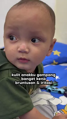 Untungnya sekarang aku udah ketemu hiboo baby balm yang ternyata jodoh banget sama kulit anakku