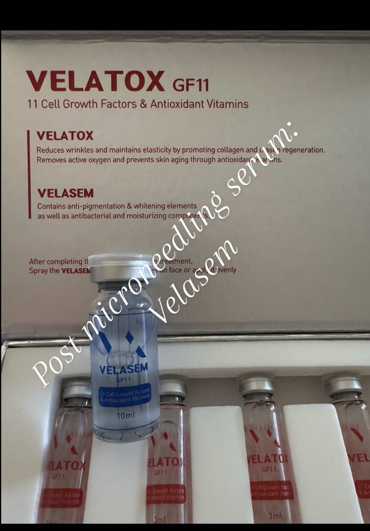 What is Velasem? Think of it as a recovery boost for your skin. Packed with growth factors, peptides, and antioxidants, it is designed to calm, repair, and rejuvenate after treatments like microneedling. It claims to help your skin heal faster, stay hydrated, and glow stronger —  even though it’s marketed to do above, results may vary and depend heavily on delivery, dose, skin type, and consistency. I will post daily updates. @AceCosm #microneedlingpostcare #microneedlingtherapy #skinover40 #antiaging #skintreatments 