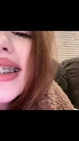 #брекеты #rek #ровныезубы