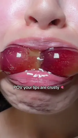 Juicy + hydrated lips🍇💦🍑🍮✨ @KNEMO™ #knemo##koreanmakeup #liplock #jellyserum #lipgloss 