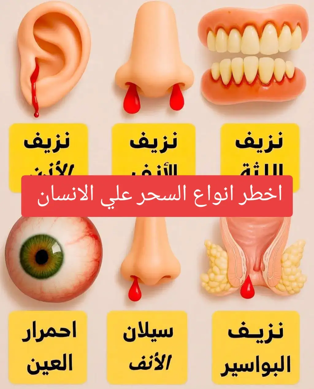 اعراض. السحر  وجود السحر في الجسم يتسبب بظهور علاماتٍ عدة عليه، منها علامات مادية تظهر على الجسم نفسه، ومنها علامات روحانية تظهر من خلال تصرفات الشخص وطريقة حياته والتغيرات التي تطرأ على طريقة تعامله مع الآخرين، وتختلف هذه العلامات باختلاف نوع السحر والهدف منه. هناك أعراض تظهر منها علاماته.....!!!!! التعب.والخمول الغثيان  النحول الدوخة الم الراس عدم التركيز خوف  حزن كآبة العصبية  كراهية الحياة  البعد عن العبادات. ثقل الصلوات عليه. كثرة الحشرات والفئران فى البيت. سماع صوت فى الأذن وكأن شخص يناديك. ألم فى البطن أو المفاصل أو الكتفين. الصداع. صفرة فى الوجه. كثرة التعرق والتبول، ضعف الشهية، تنمل أو حرارة أو برودة في الأطراف وخفقان في القلب. وحزن وضيق في الصدر وأرق في الليل، انفعالات شديدة من خوف وغضب غير طبيعي . حتى بعض المصابين يتضايقون من شهر رمضان بسبب #المس او السحر.  #السعوديه_الكويت_الامارات_قطر_عمان_البحرين_اليمن #فرنسا🇨🇵_بلجيكا🇧🇪_المانيا🇩🇪_اسبانيا🇪🇸 #creatorsearchinsights2025 #الخليج_العربي_اردن_عمان_مصر_تونس_المغرب 