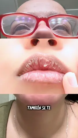 Lo mejor que uso para labios secos #Skincare #BeautyTips #LabiosHidratados #labiossecos 