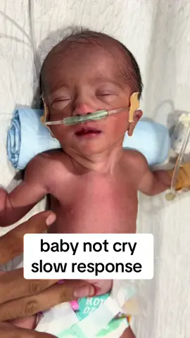 baby not cry #slow response #newbron #unfreezemyacount 