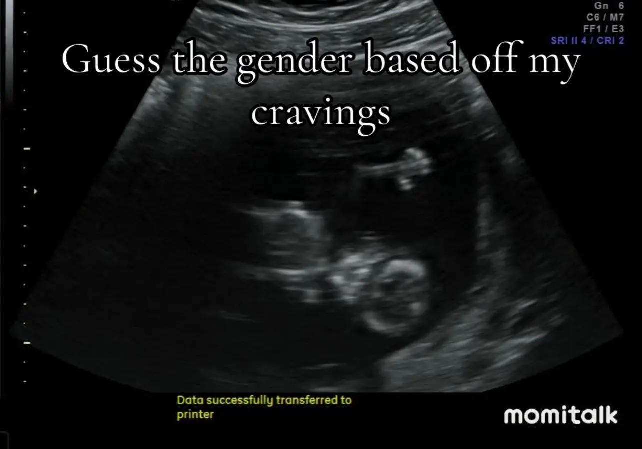 We find out Tuesday afternoon, I’m so excited🥰💙🩷 #pregnant #fyp #fypシ #trending #viral 