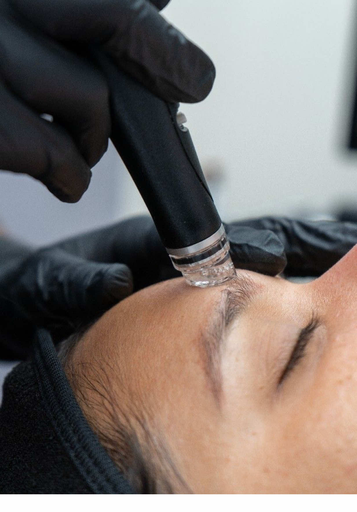 No wonder hydrafacials are one of the most booked skincare treatments worldwide! ✨ With its one-of-a-kind vortex technology, the authentic hydrafacial device goes beyond what any other treatment can do. In just one session, it deeply exfoliates, performs gentle peels, clears congested pores, infuses nourishing serums, provides LED light therapy, and even includes lymphatic drainage!  We offer a range of hydrafacial options tailored to your goals, time, and budget—so you can get the glow you’ve been waiting for 🤍 Booking link located in our bio - Or text us at (647) 917 6933  #hydrafacial #hydrafacialtoronto #extractions #facials