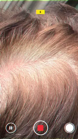 👨‍🦱 Cansado dos fios brancos? ✨ Tonalizante masculino: rápido, prático e natural! 👉 Clique e garanta já o seu na Shopee! #tonalizantecabelomasculino#tonalizantekissnewyork#fimdoscabelosbrancos#tonalizantemasculino#tonalizante 