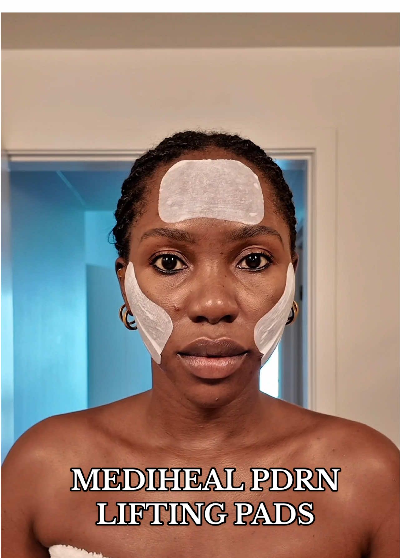 The @MEDIHEAL PDRN Lifting Pads and Madecassoside Moisture Blemish Repair Sun Serum have helpful in dealing with an oily T Zone & hyperpigmentation. Will keep you guys updated on the progress. #medihealtonerpad #skincareroutine #hyperpigmentation 