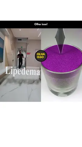 Descubra tudo sobre lipedema e como cuidar da sua saúde! 💡 Confira os cortes incríveis do @dr.lucasluquettioficial e transforme seu conhecimento! #medicina #lipedema 