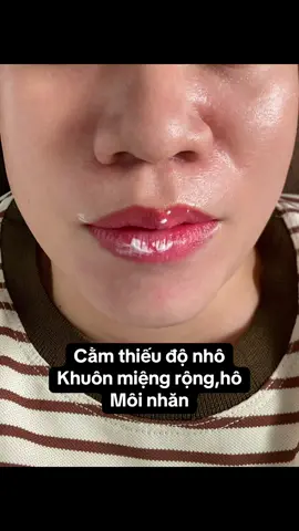 #Mie #filler #tiemmoi 