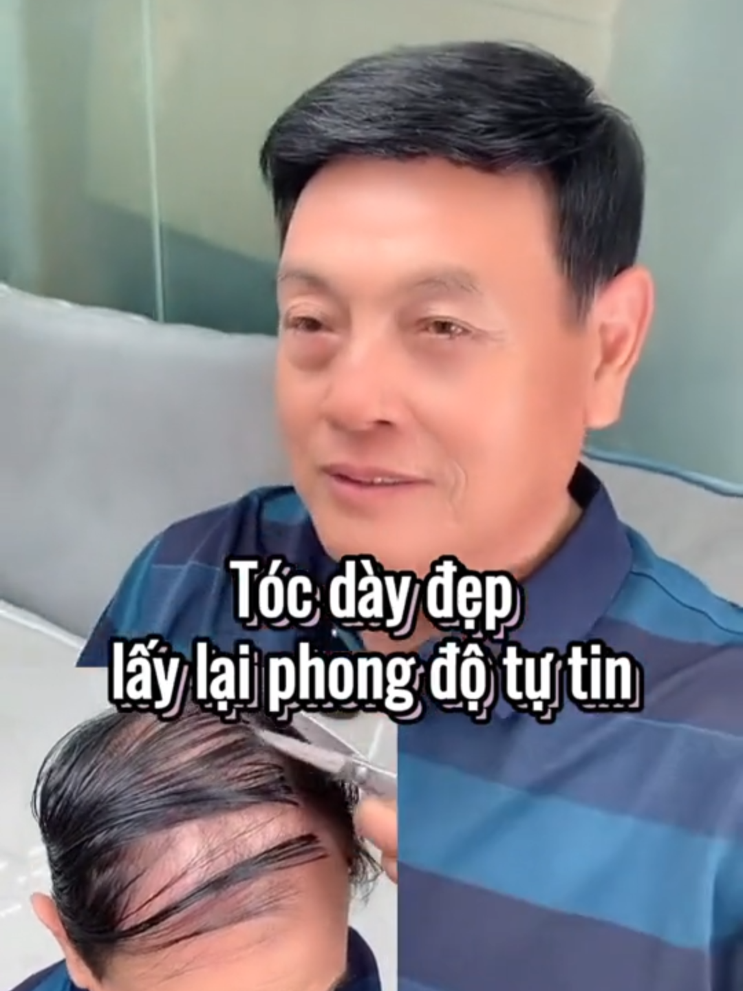 Xoá tan nỗi lo tóc hói nhờ dầu gội kích mọc tóc DHT #kichmoctoc #daugoiDHT #daugoikichmoctoc
