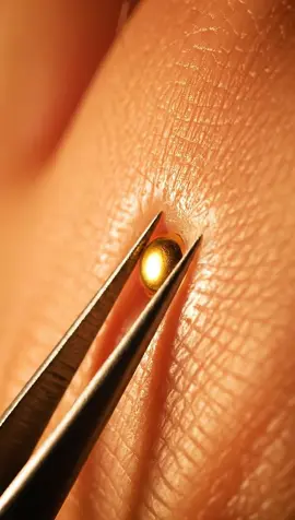 Golden foil pimple pop ✨🥇 Glossy burst, crisp crackle, and perfectly satisfying ASMR. #ASMR #Slime #Satisfying #OddlySatisfying #AI 
