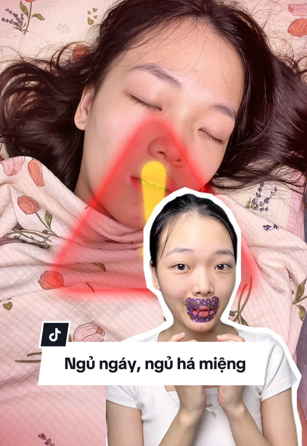 Ai ngủ ngáy, ngủ há miệng nên có cái miếng dán chống ngáy này nha #miengdanchongngay #miengdanchongngaybebechic #bebechic #review #phuongkhoreview 