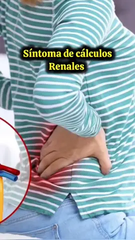 Tienes cálculos renales 😔 entonces te compartiré este vídeo ❤️‍🩹💥 #salud #riñonesenfermos  #calculosrenales #calculo #health