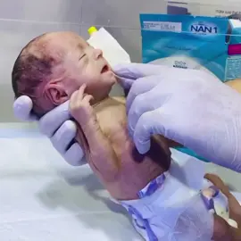 she is recovering soon and bote feesing trial  #fentysuperbrandday #LanguageLearning #premature #neonatologist #bottlefeeding 