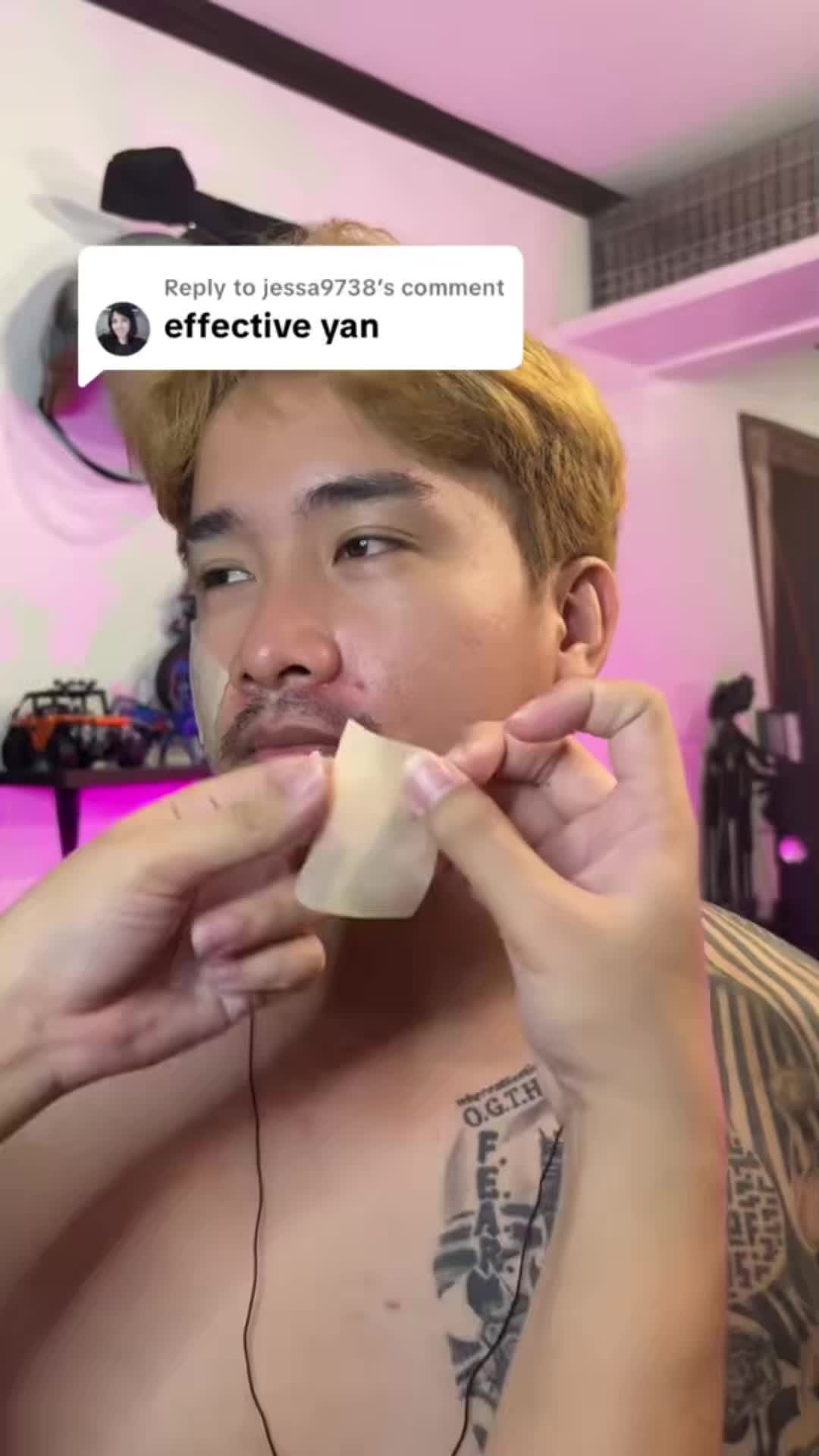 ❤❤Solution for surgery scars! Pressure therapy prevents keloids 