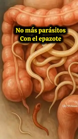 Lo que debemos saber y que hacer sobre parásitos intestinales 🪱🐛🦠 #parasitologia #parasites #parasitosintestinales #trichuri #ameba 