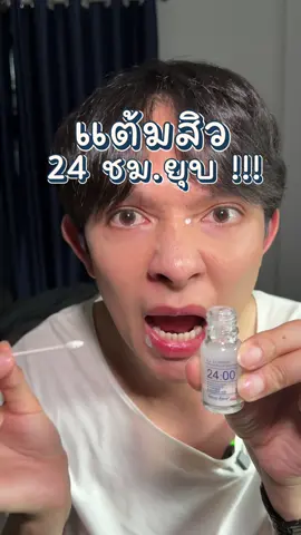 เซรั่มแต้มสิว ICE LERSKIN ยุบภายใน 24 ชม. !!! #แต้มสิว #ใช้ดีบอกต่อ #iceleskin #รักษาสิว #CapCut 