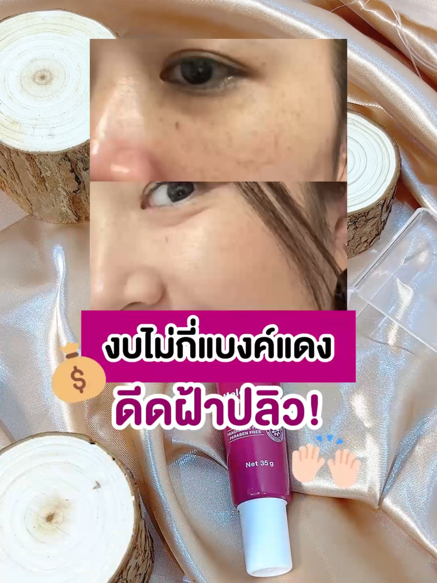 งบไม่กี่แบงค์แดง แต่ฝ้าปลิววว~ลองเลย💸#Melamii #เมลามี่ #ฝ้า #ฝ้าซ้ำซาก #ครีมทาฝ้าเมลามี่หลอดม่วง
