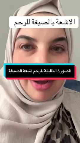 #الدكتورة_منال_الحسين#علاج_العقم_للزوجين #صورة_ظليلة_للرحم 