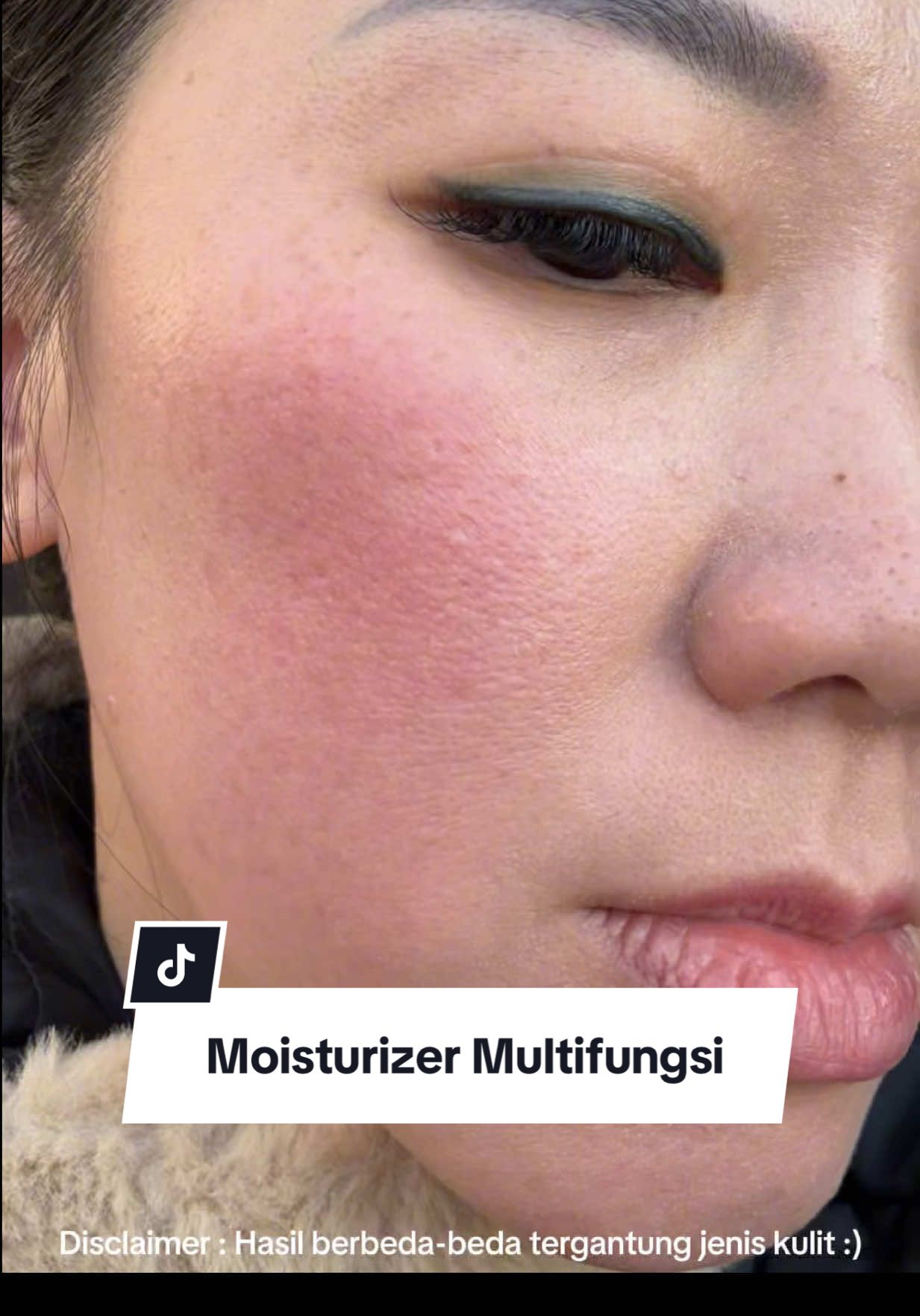 Skincare apapun yang kalian pakai Moisturizer multifungsi ini wajib ada, Gak cuman untuk memperbaiki Skin Barrier dimuka tapi juga bisa mengatasi kemerahan dibadan akibat sunburn, luka bakar dan eczema😍