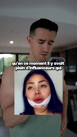 Comment perdre le double menton ? 😔 