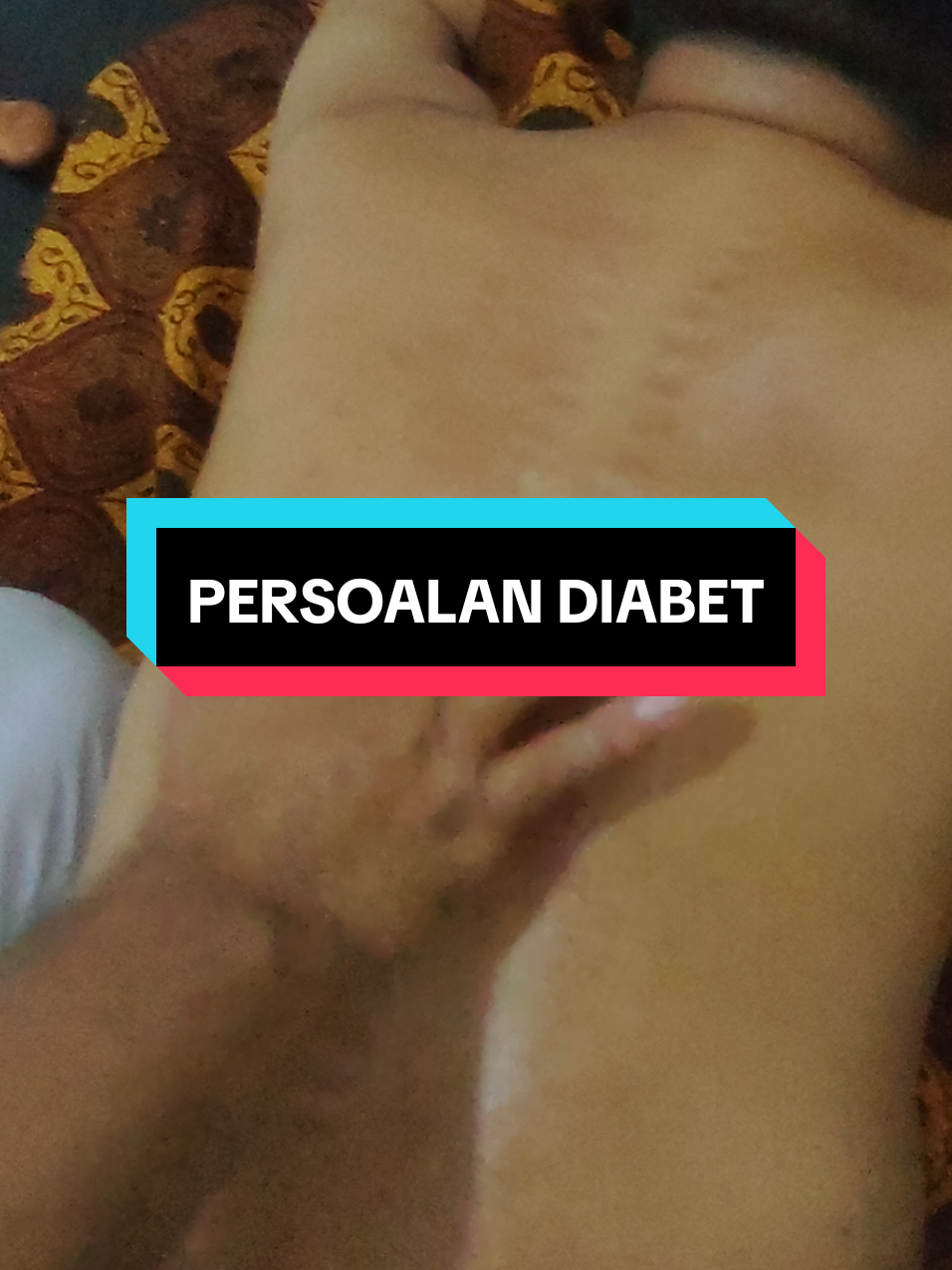 totok punggung untuk gula darah tinggi #fyp #terapi #totokpunggungpamulang 